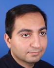 After Hair Transplant&nbsp;Front